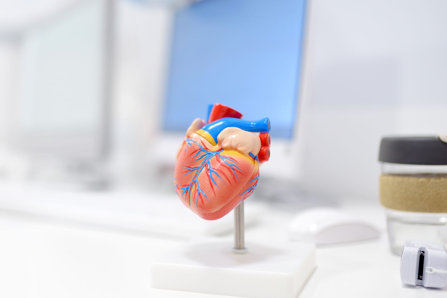 Enlarged heart